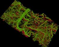 Stanford scientists develop new technique for imaging cells and tissues under the skin