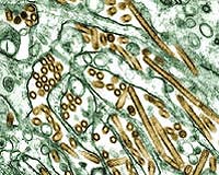 Hong Kong reports second human case of bird flu