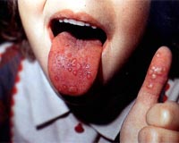 Beijing confirms first virus deaths: report