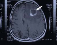 Does tissue decelerate therapeutic heavy ion beams