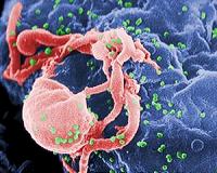 Search for AIDS cure pushes ahead despite setbacks
