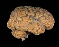 Area Responsible For Self-Control Found In The Human Brain