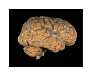 A Butterfly Effect In The Brain
