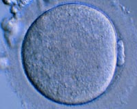 Facebook, Apple to cover women's egg-freezing: report