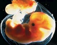 Scientists urge moratorium after Chinese 'edit' human embryos