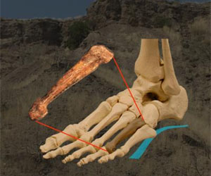 Discovery Could Change Views Of Human Evolution