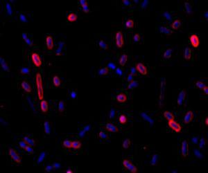 Microbial Missing Link Discovered After Man Impales Hand on Tree Branch