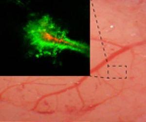 Improved nanoparticles deliver drugs into brain