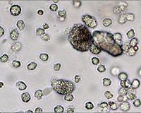 Study of immune system regulation to improve treatment of chronic disease