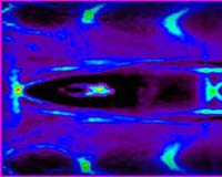 Laser-Based Device Offers Alternative To Video Surveillance