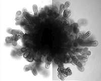 New lung 'organoids' in a dish mimic features of full-size lung