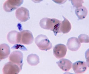 Cambodians fight malaria with the push of a button