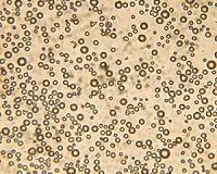 Popping microbubbles help focus light inside the body