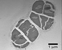 Microbe's Innovation Brought Doom to Earth