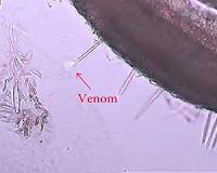 Microscopic lense captures first ever video of a jellyfish sting