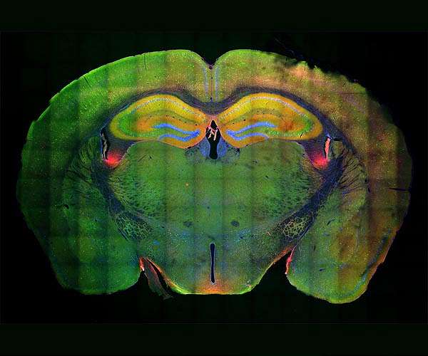 Connectivity of language areas unique in the human brain