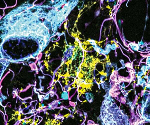 Imaging method reveals new cells and structures in human brain tissue