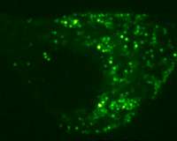 New method improves accuracy of imaging systems