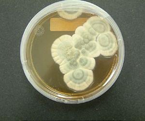 Unlike we thought for 100 years: Molds are able to reproduce sexually