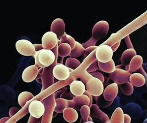 Advancing next gen biofuels by turning up the heat on biomass pretreatment processes