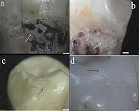 Neanderthals had the teeth to eat hard plants