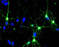 Milestone In The Regeneration Of Brain Cells: Supportive Cells Generate New Nerve Cells