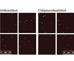 New method for diagnosing malaria