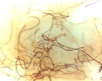 Scientists A Step Closer To Producing Fuel From Bacteria