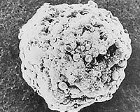 Women in poor countries bear brunt of cancer epidemic