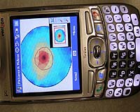 Researchers Develop Method For Transmitting Medical Images Via Cell Phones
