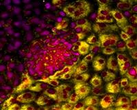 Researchers discover transitional stem cells