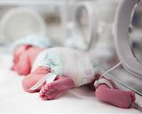 Unique womb-like device could reduce mortality and disability for extremely premature babies