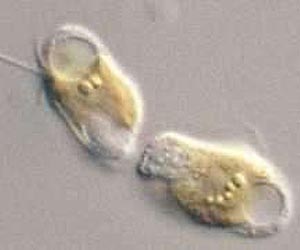 Rare Toxic Algae Identified