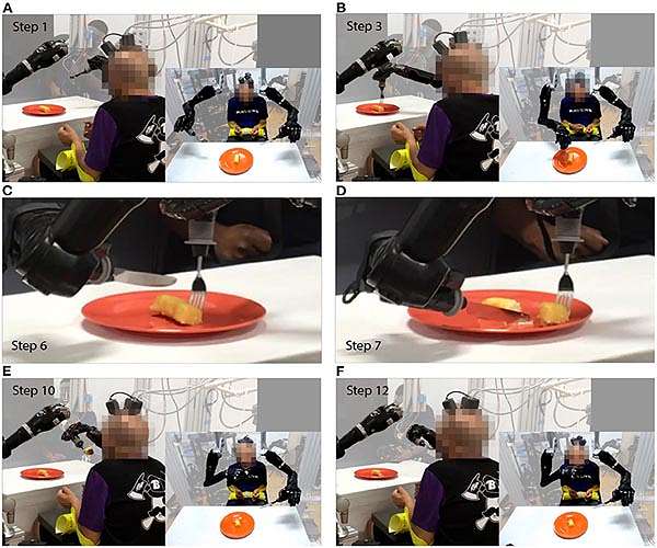 Robotic arms connected directly to brain of partially paralyzed man allows him to feed himself
