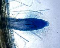 How plants harness microbes to get nutrients