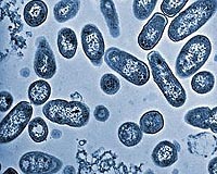 Study: Bacteria may limit space travel