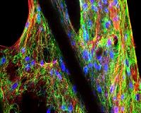 Soft-tissue engineering for hard-working cartilage