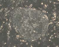 UW-Madison Scientists Guide Human Skin Cells To Embryonic State