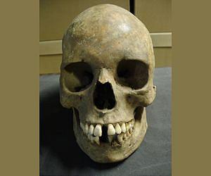 Researchers reconstruct genome of the Black Death