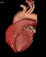 Engineering The Heart Piece By Piece