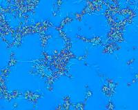New Technique Sheds Light on Human Neural Networks