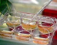 Many Paths, Few Destinations: How Stem Cells Decide What They'll Be
