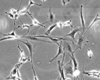 Doctor injecting patients with stem cells