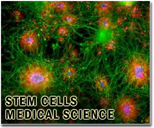 Stem-cell work closes a door to AIDS virus