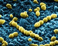 Shuttle Brings Space-Grown Strep Bacteria Back For Study