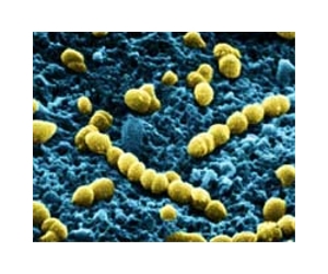 Battle Of The Bugs Leaves Humans As Collateral Damage