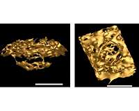 Complex bacterium writes new evolutionary story