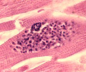 Common parasite may trigger suicide attempts
