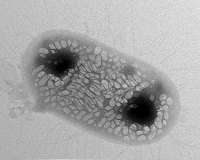 Scientists design bacteria to reflect 'sonar' signals for ultrasound imaging
