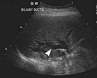 Dolphin algorithm could lead to better medical ultrasounds